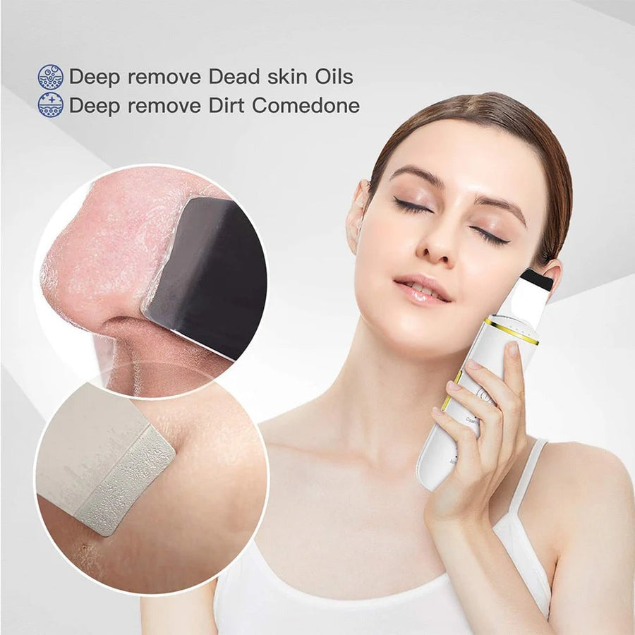 Cetosy™ Blackhead Spatula - ultrasonic technology deep cleans your pores and boost circulation