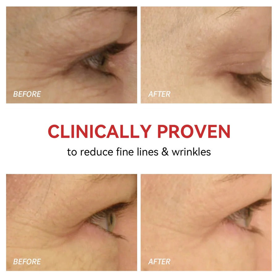 Cetosy™ Eyelume Therapy - Red Light Therapy for Eyes | Reduce Fine Lines and Wrinkles | Anti Eye Bags