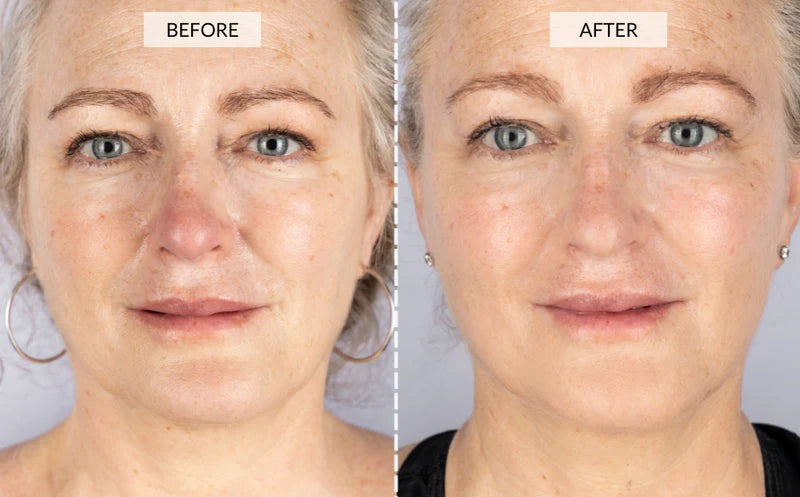Cetosy™ 7 color LED Therapy Mask: smoother skin effortlessly