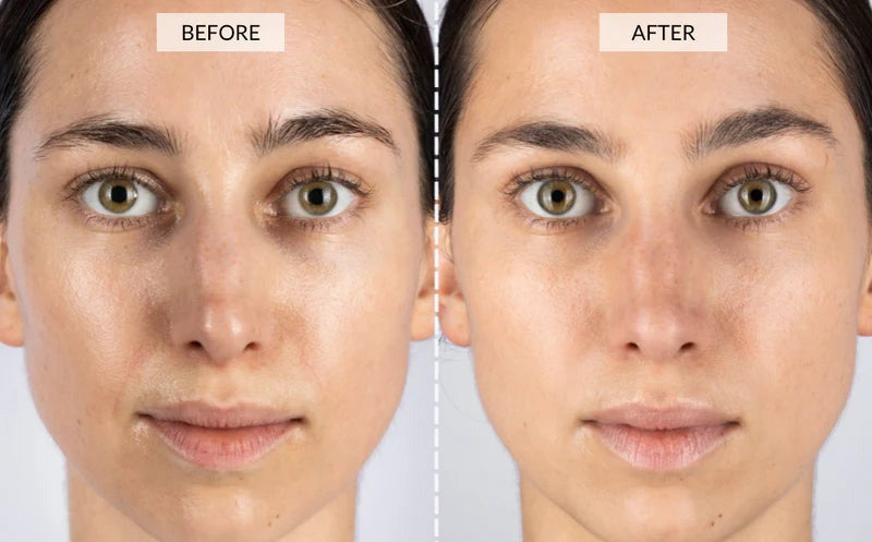 Cetosy™ 7 color LED Therapy Mask: smoother skin effortlessly