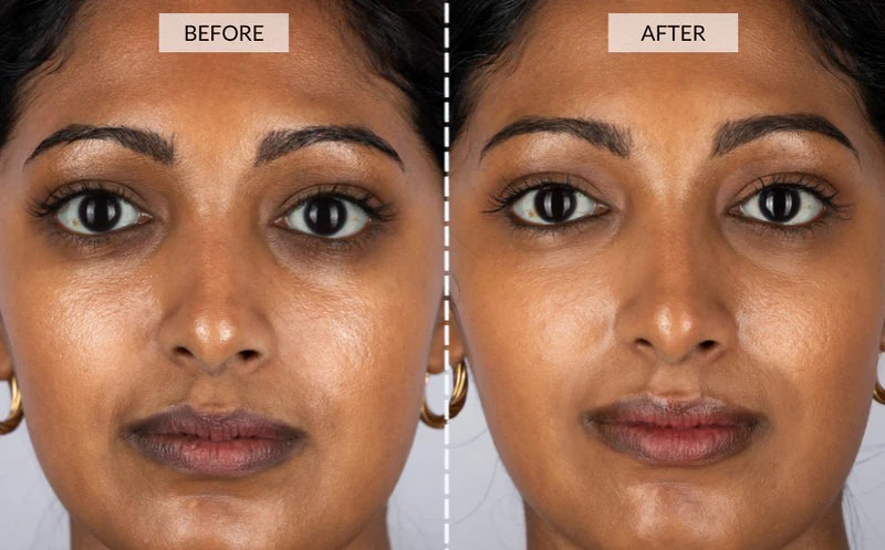 Cetosy™ 7 color LED Therapy Mask: smoother skin effortlessly
