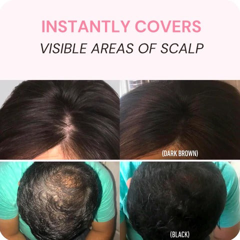 Cetosy™ Magic Hair Root Cover Up