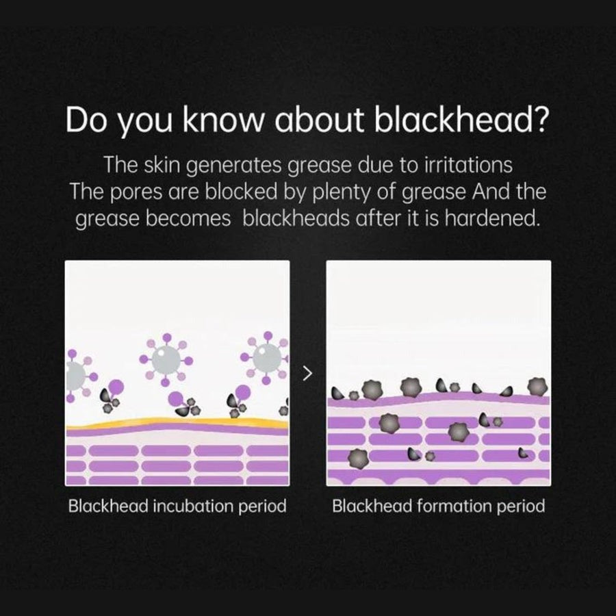 Blackhead Peeling Mask