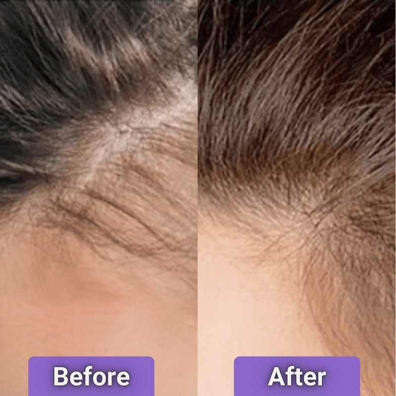 Cetosy™ 4-in-1 Growth Brush
