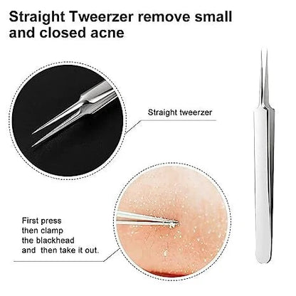 Professional Facial Blackhead & Hair Remover (3PCS+BOX)