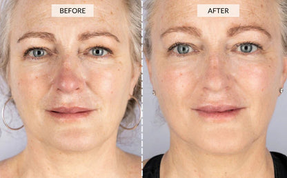 Cetosy™ 7 color LED Therapy Mask: smoother skin effortlessly
