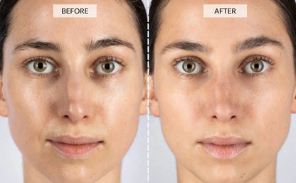 Cetosy™ 7 color LED Therapy Mask: smoother skin effortlessly