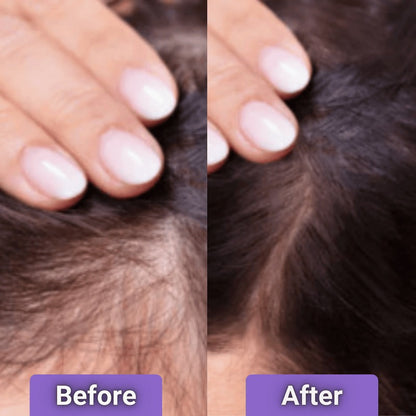 Cetosy™ 4-in-1 Growth Brush