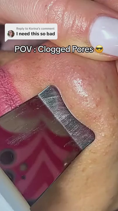 Cetosy™ Blackhead Spatula - ultrasonic technology deep cleans your pores and boost circulation